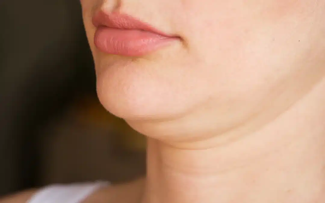 3 Ways To Improve Your Double Chin