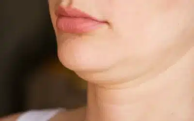 3 Ways To Improve Your Double Chin