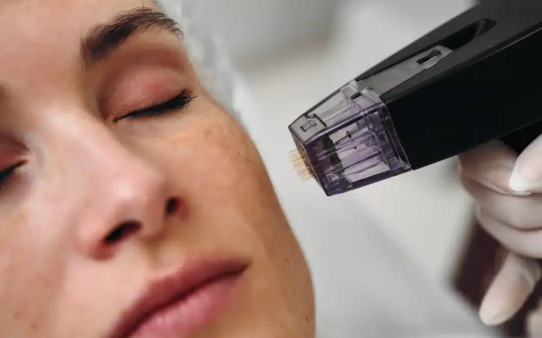 The solution to preventing  fine lines and wrinkles, if you are young enough