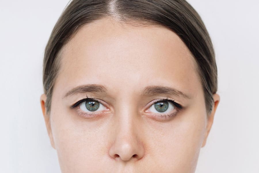 Top 5 Benefits of Lower Eyelid Cosmetic Surgery
