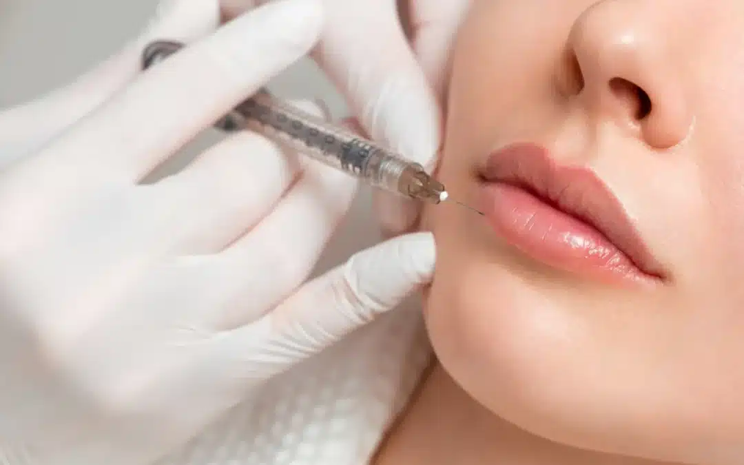Fat Transfer VS Filler: Which is Better For You?
