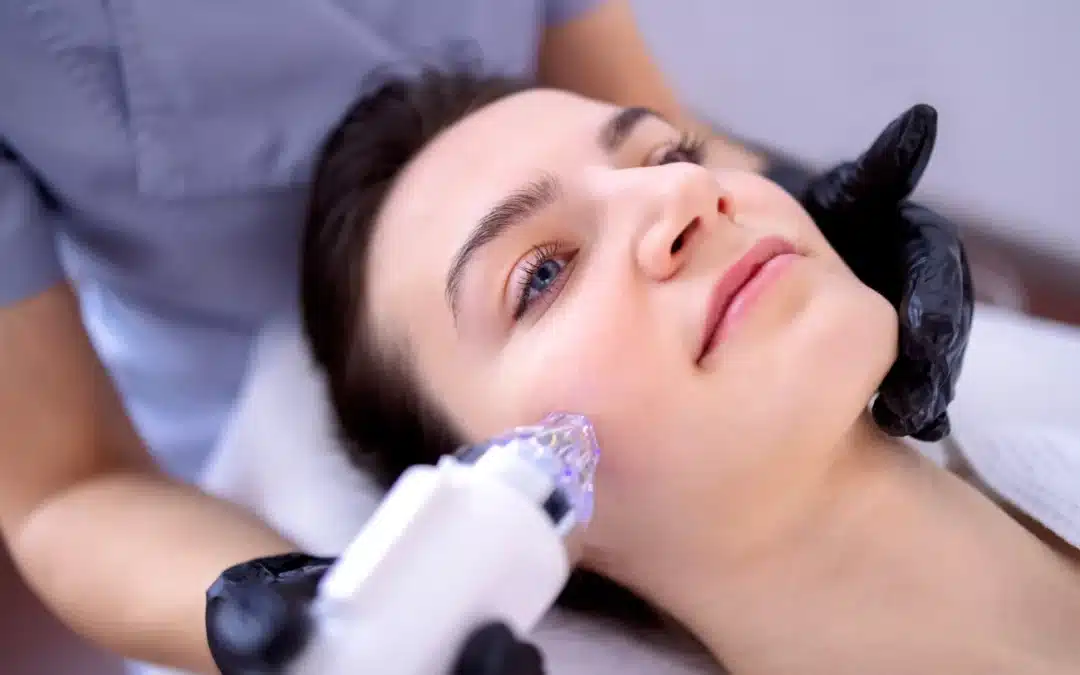 What Is Radio Frequency Microneedling?